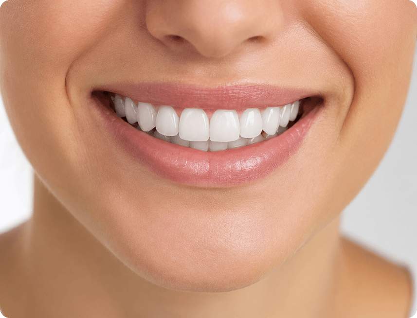 Composite bonding consultation with patient reviewing smile results at a High Wycombe dental practice